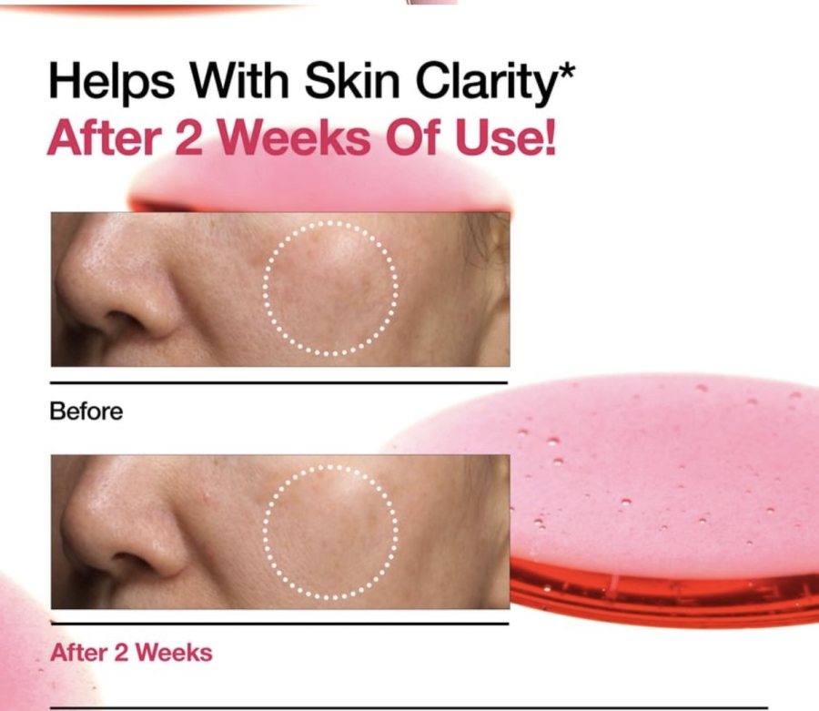 Anua Niacinamide 10% + TXA 4%